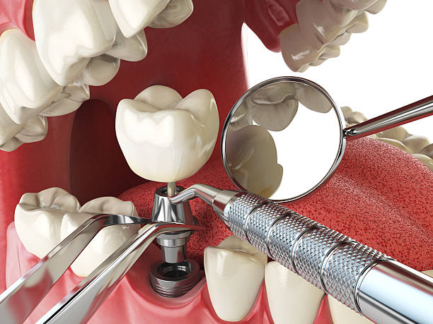 Dentist for Dental Trauma in SC