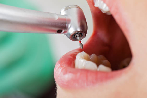 Best Emergency Tooth Extraction  in Goose Creek, SC